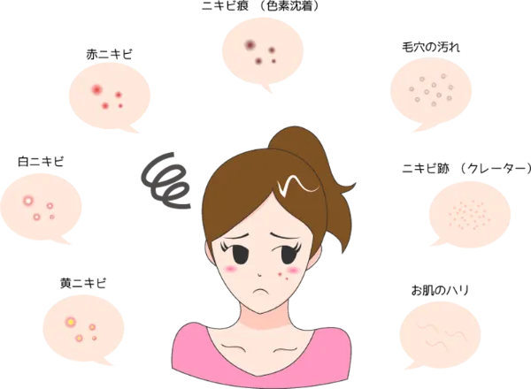ダーマペンに効果的なお悩み一覧