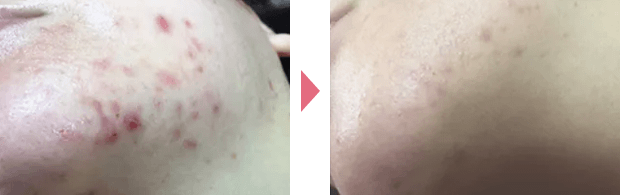 症例1